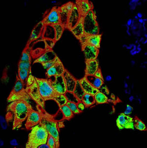 Rita Allen Foundation Scholar Senthil Muthuswamy uses tumor “organoids” to study the roles of cell polarity in cancer. (Image: Senthil Muthuswamy, Cancer Research Institute, Beth Israel Deaconess Medical Center)