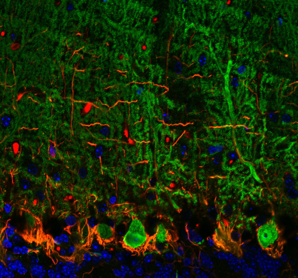 Rita Allen Foundation Scholar Tom Maniatis studies molecular neuroscience, including the disease mechanisms of amyotrophic lateral sclerosis (ALS). ALS involves degeneration of Purkinje neurons, which are among the largest brain neurons and form abundant dendritic spines. Purkinje neurons (shown here in green) function in motor coordination in the brain’s cerebellum. (Image: Wikimedia, Sbrandner)