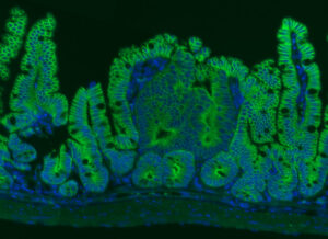 Rita Allen Foundation Scholar Joshua Mendell has studied the involvement of microRNAs in cancer. His lab found that a microRNA called miR-26 could suppress the formation of intestinal tumors—shown here in a mouse model. Intestinal epithelial cells are labeled in green, and cell nuclei are labeled in blue. (Image: Lauren Zeitels)