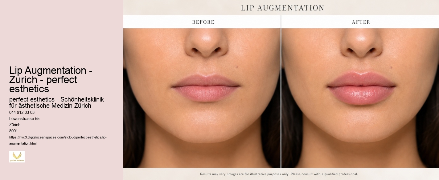 Lip Augmentation - Zurich - perfect esthetics