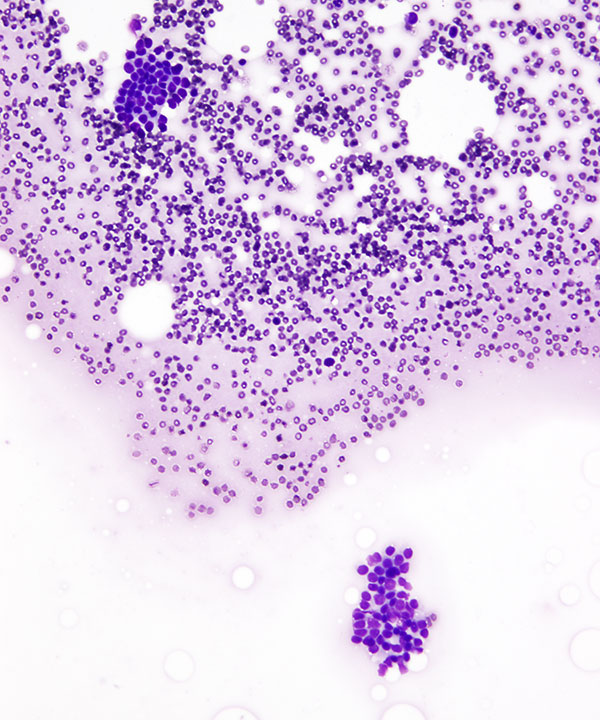 image showing 'Benign Ductal Cells'