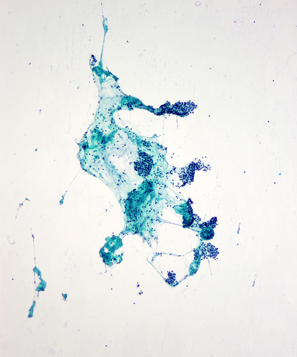 4 : Breast Benign Ductal Cells