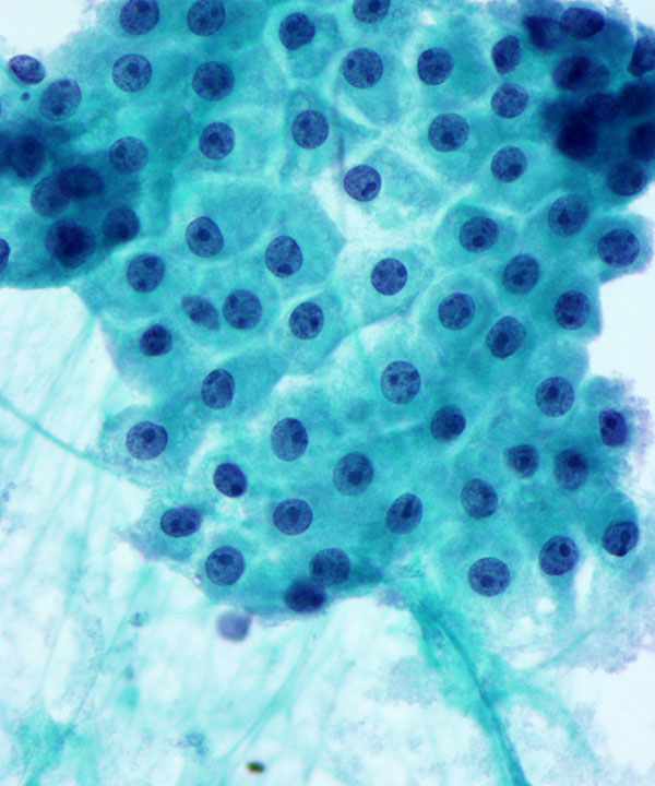 9 : Breast Benign Ductal Cells