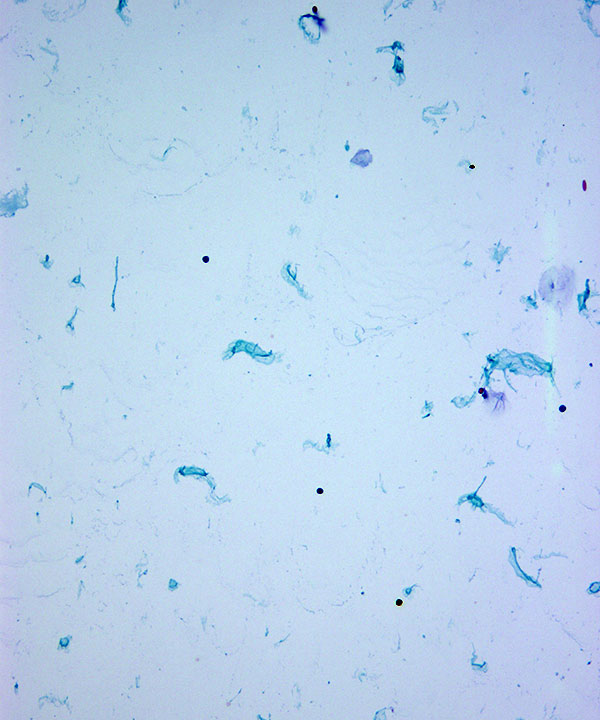 image showing 'Normal CSF'