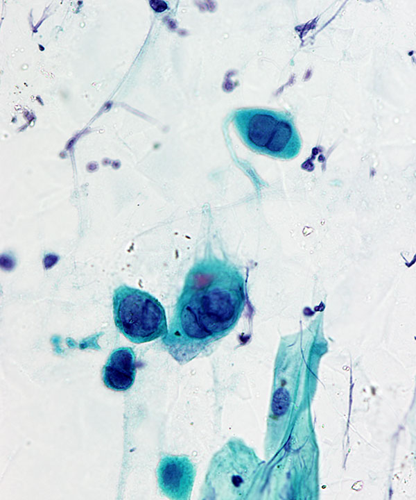 02 :  Infectious Diseases Herpes Virus Infection