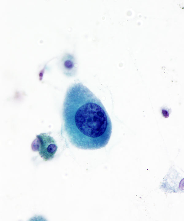 image showing 'Adenovirus Infections'