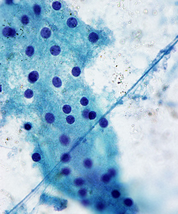 05 : Kidney Normal Kidney