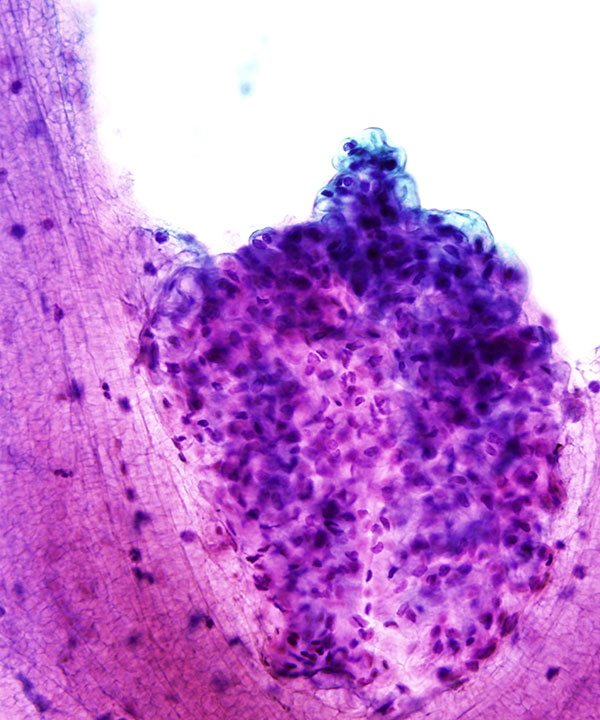 10 : Kidney Normal Kidney