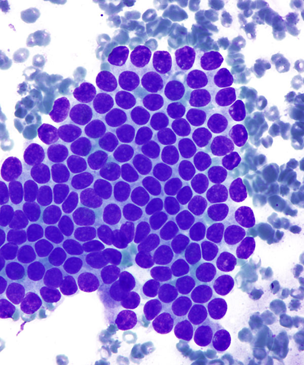 14 : Liver Normal Liver