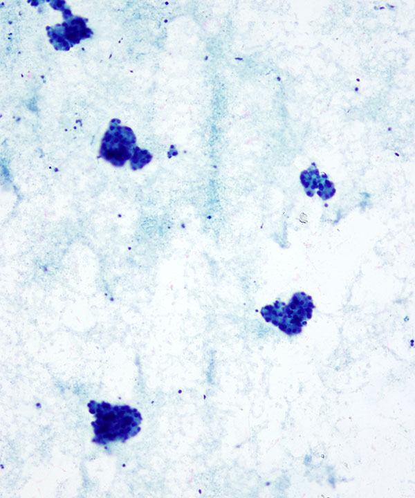 image showing 'Normal Pancreas Acinar Cells'