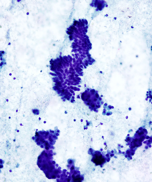 image showing 'Normal Pancreas Ductal Cells'