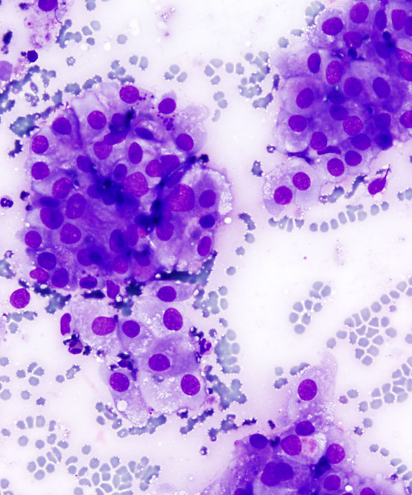 02 : Salivary Gland MASC