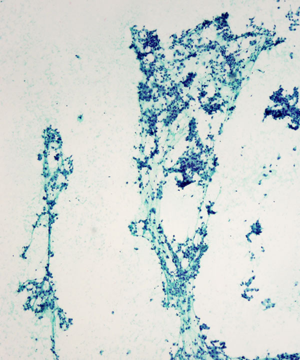 05 : Salivary Gland MASC