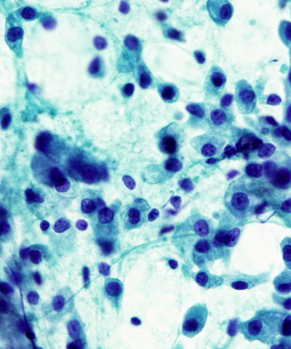 08 : Salivary Gland MASC