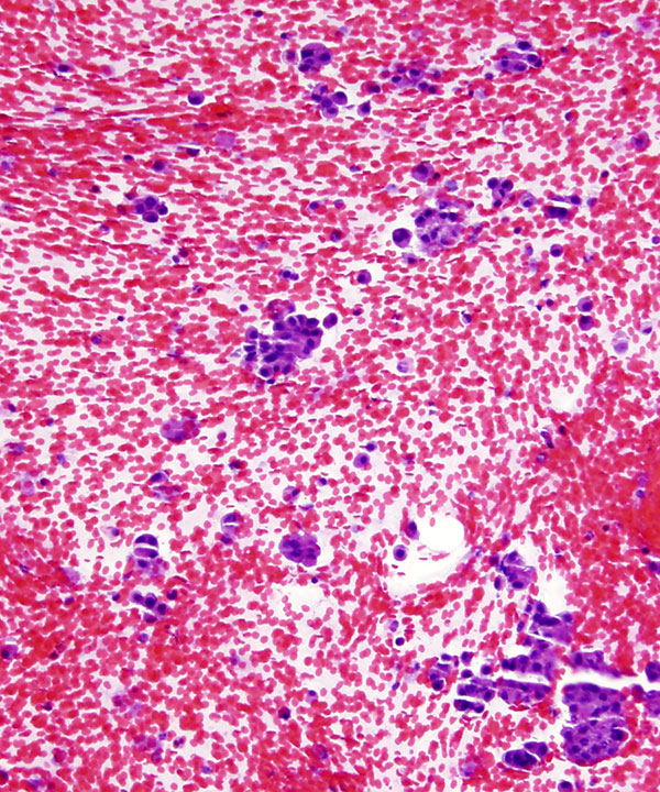 10 : Salivary Gland MASC