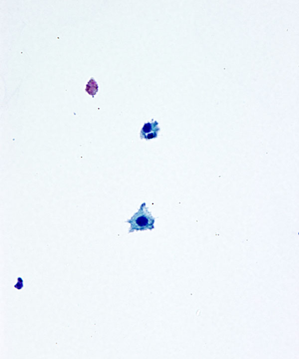 image showing 'Normal Urine'
