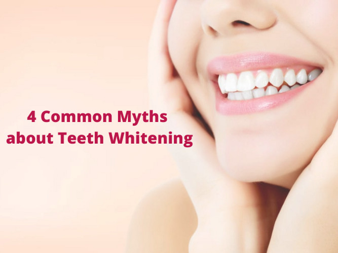 Teeth Whitening Myths Debunked: What Really Works
