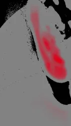 Interference