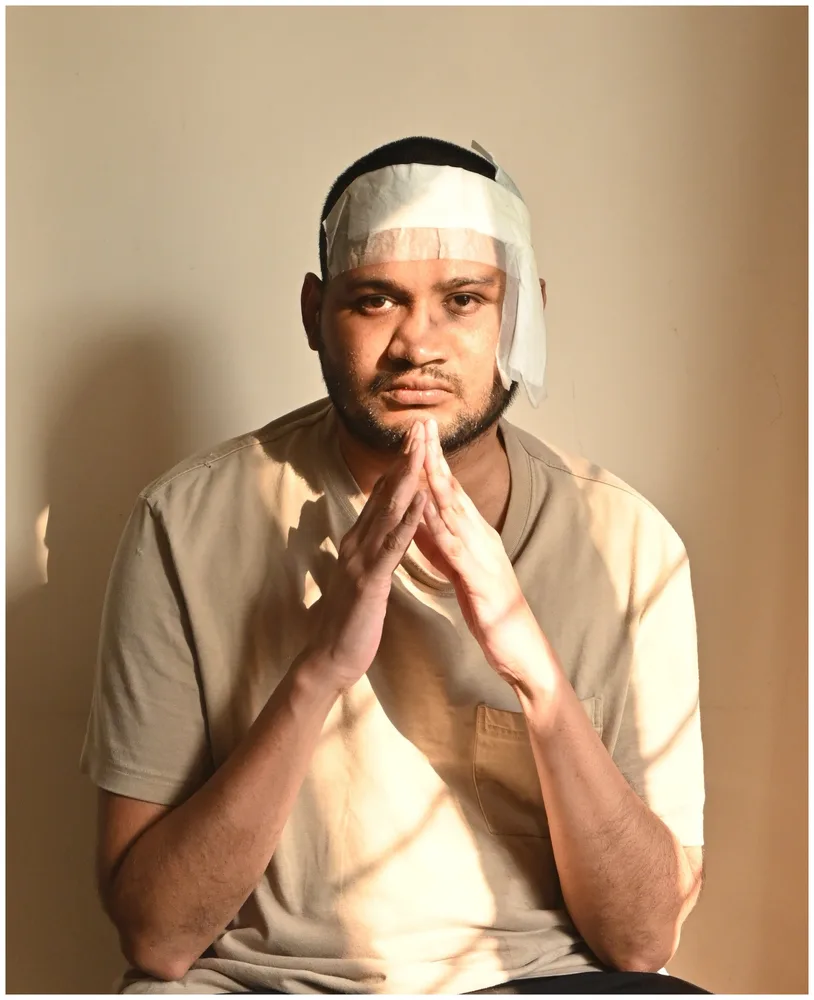 post surgery self portrait