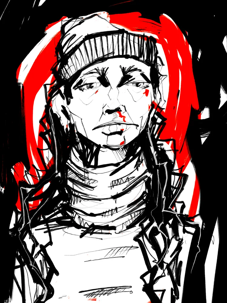 Wounds Heal Us #3