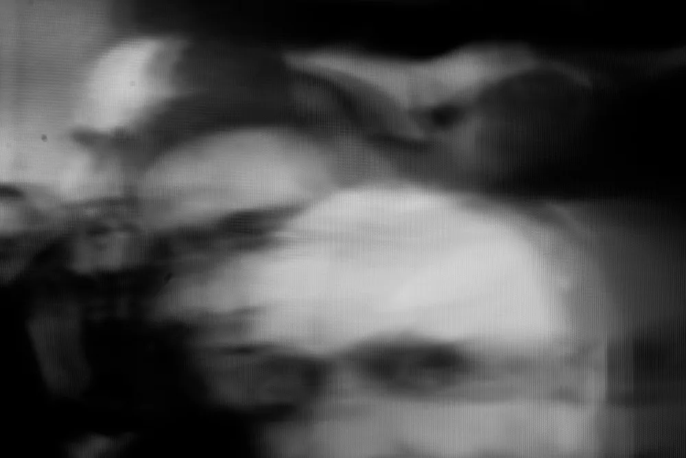 Dead Retina