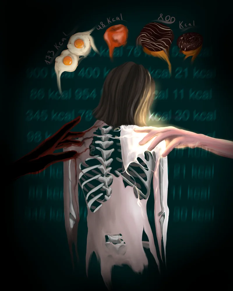 Anorexia