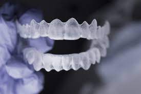 clear retainers to straighten teeth
