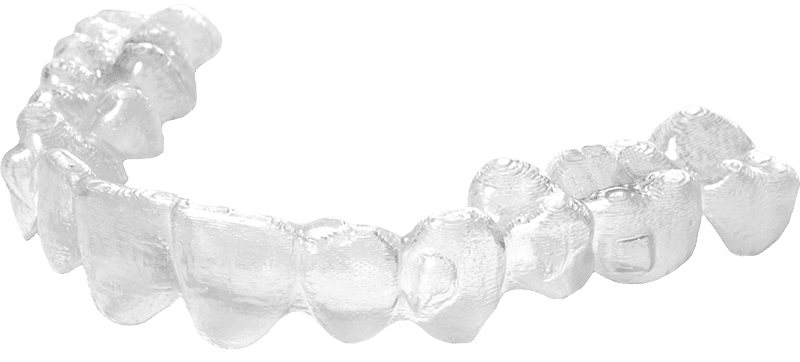 clear arc aligners