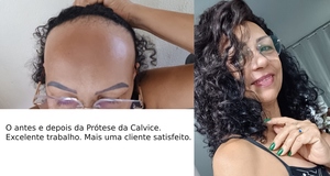 oferta Prótese de calvice feminina da empresa Rodrigo Fábrica de Perucas