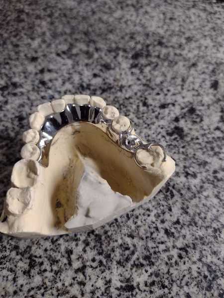 foto 2 de ML Prótese Dentária