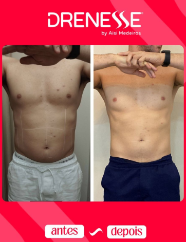 Imagem 9 da empresa Drenesse Clínica de Estética - Unidade Capim Macio