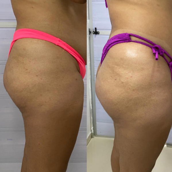 foto 2 de Clara Melo Estética Avançada