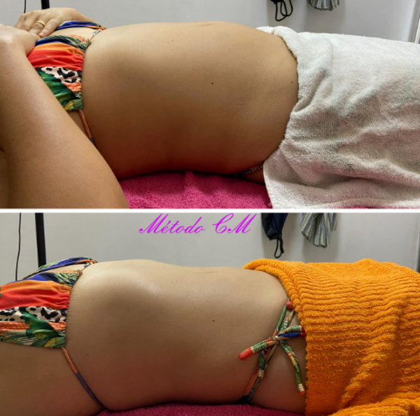 foto 3 de Clara Melo Estética Avançada