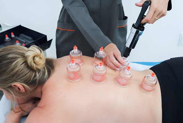 oferta Ventosaterapia da empresa Saulo Massoterapeuta