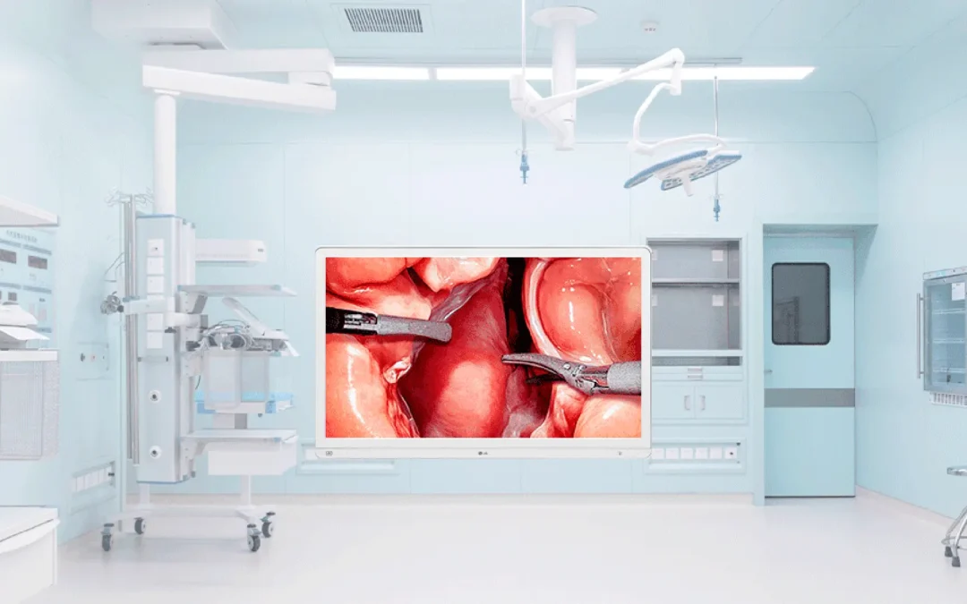 LG 32HS710S: un monitor quirúrgico 4K pensado para agilizar y asegurar el trabajo en el quirófano