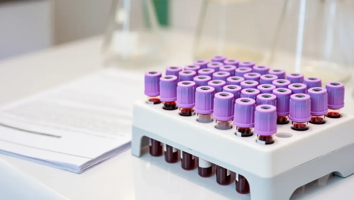Why thyroid disorders are so much more common in women