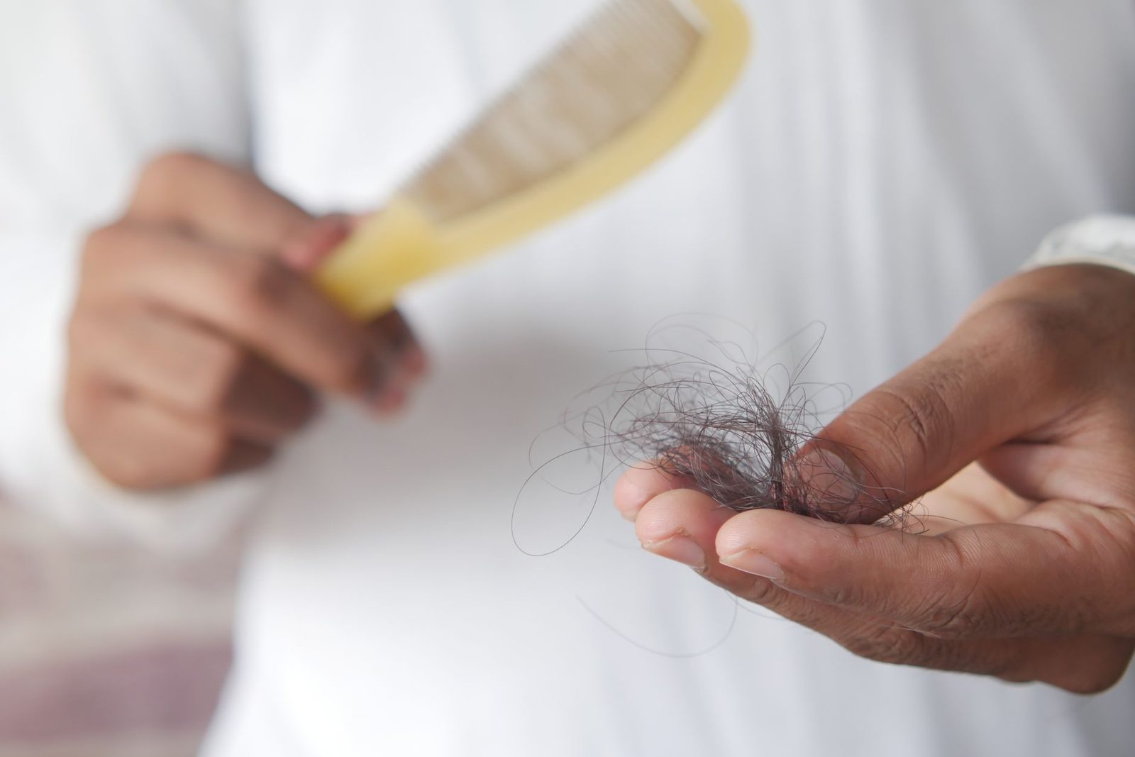 Female Hair Loss: Causes, Prevention, and Treatment Options