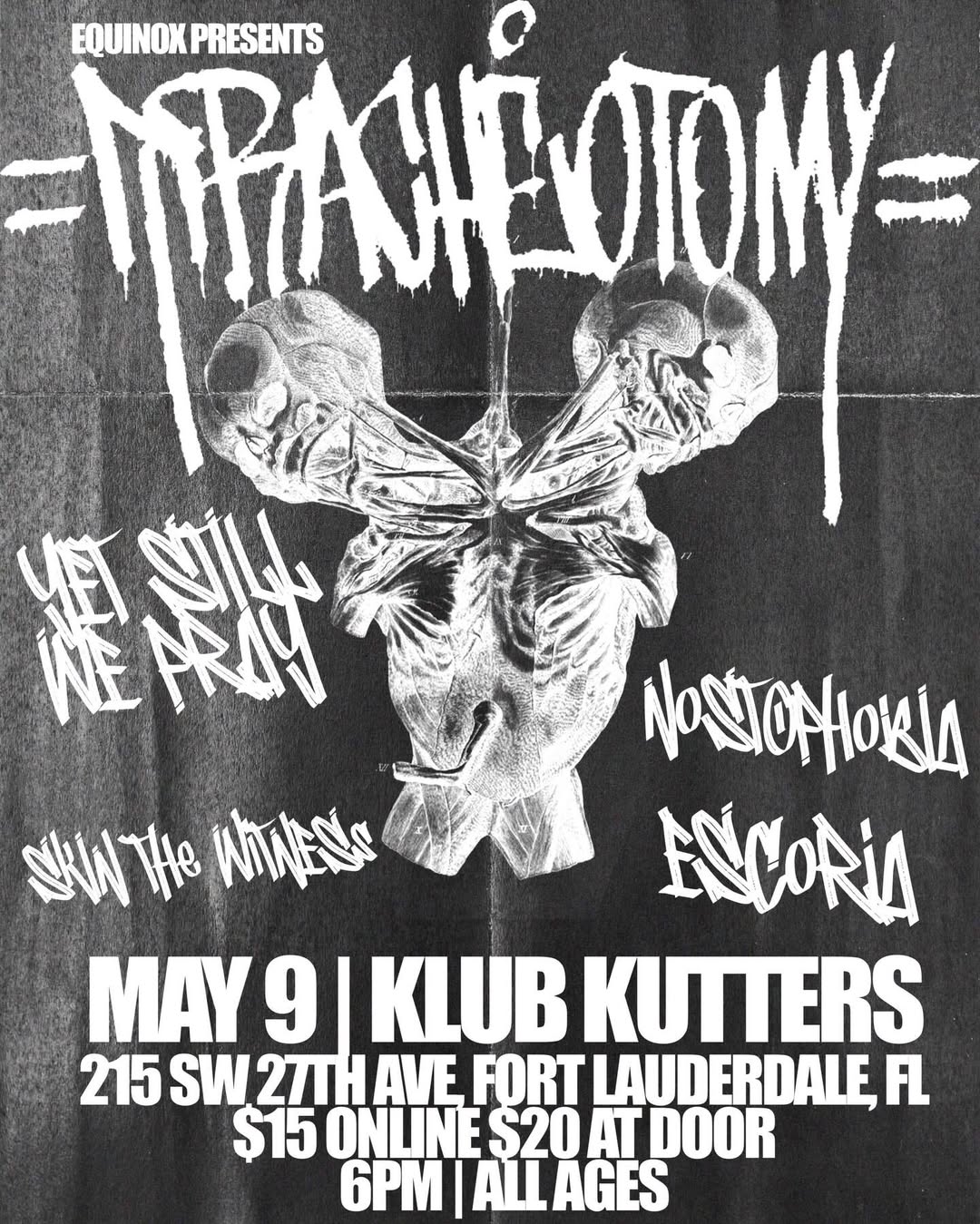 Flyer for Tracheotomy + Yet Still We Pray +
