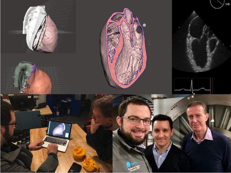 Anatomic Heart Sliced in 4 TEE Views