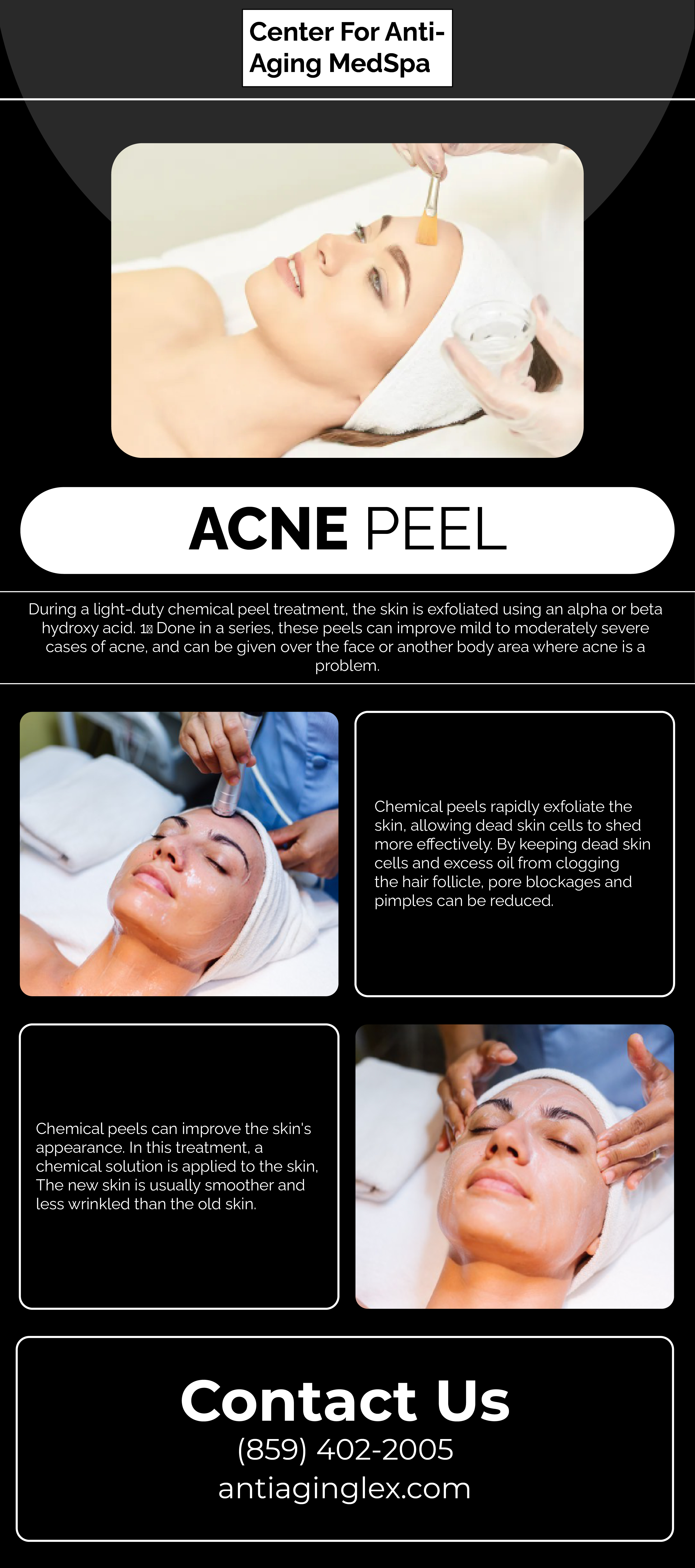 Professional acne pee treatment in USA at Centre For Anti-Aging Med Spa