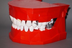 Dental Demonstration Model / Modèle de démonstration dentaire