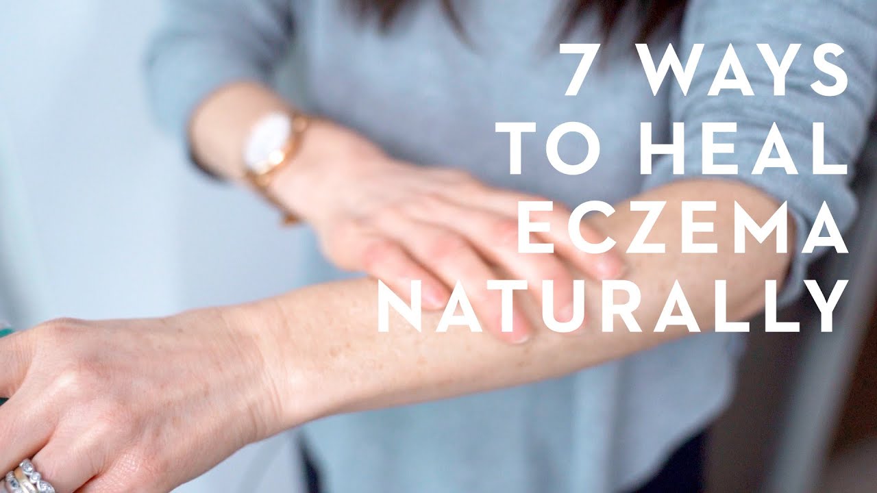 7 Things You Must Know To Get Rid Of Eczema Naturally Youaccel Media